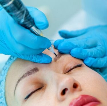 Restructuration de sourcil