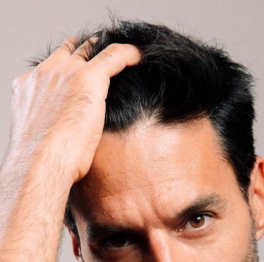 greffe de cheveux fue