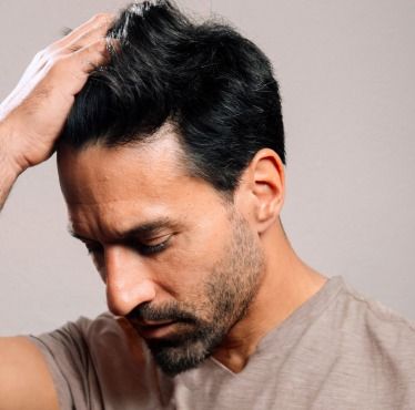 greffe de cheveux fue