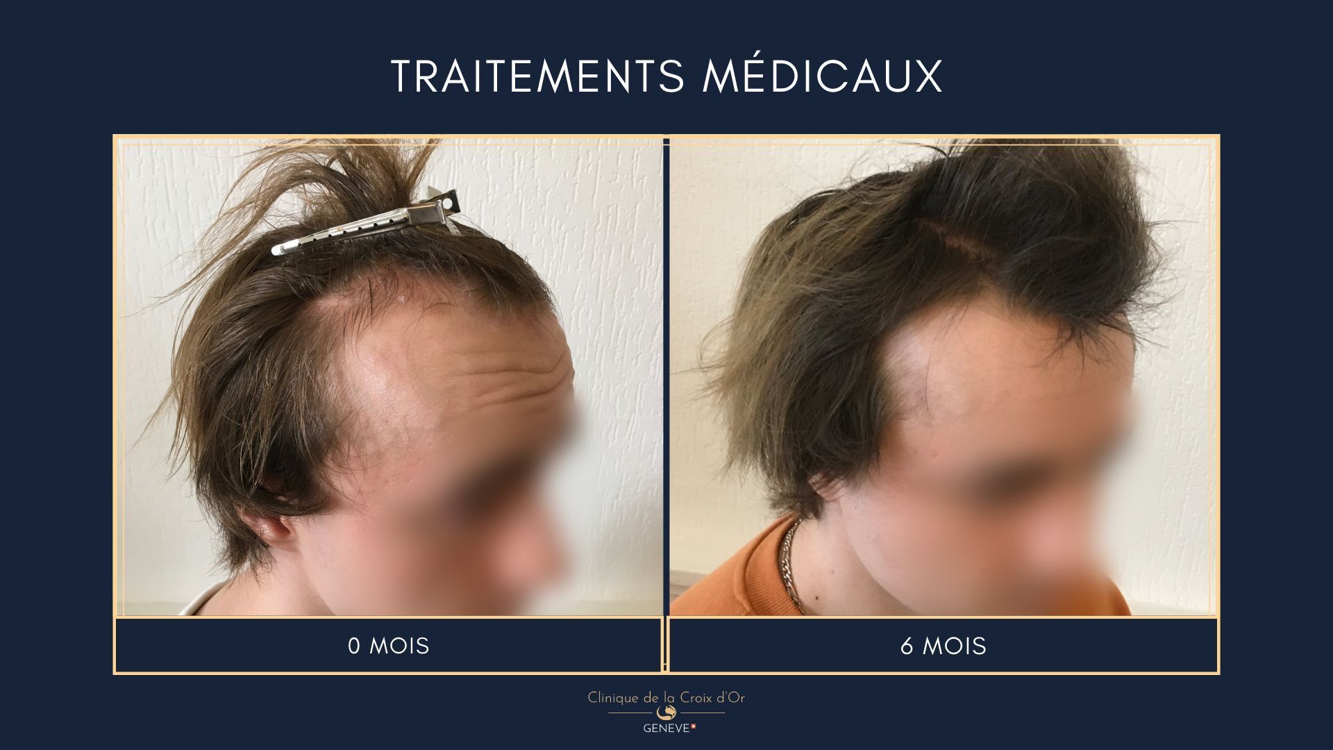 Medical treatments