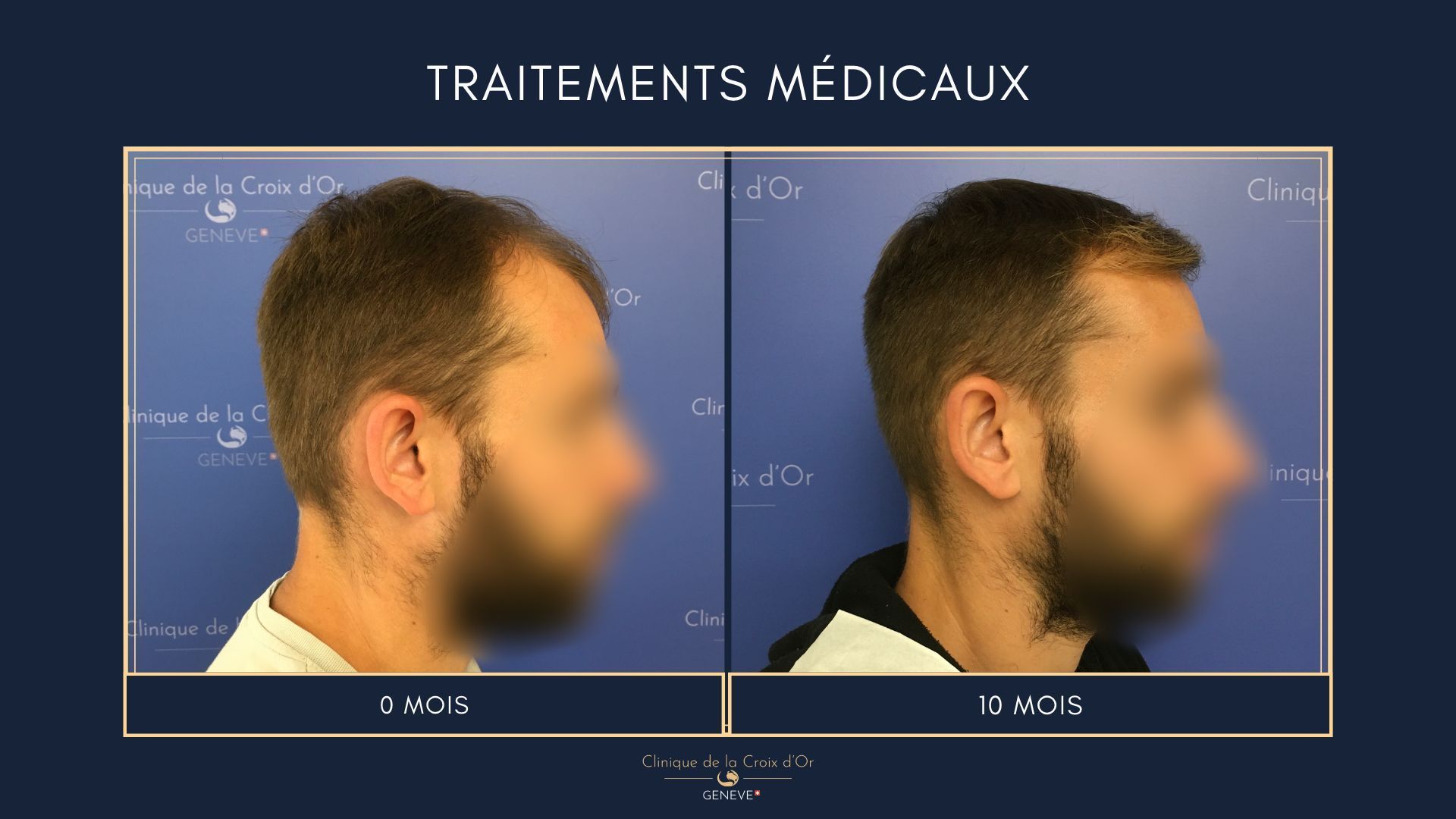Medical treatments